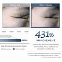 Vitamin U Eye Cream 15g thumbnail 4